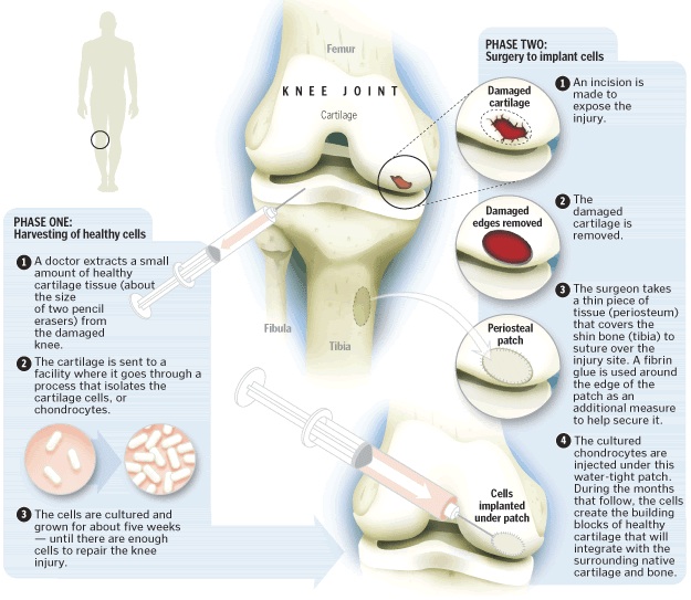 articular_cartilage articular cartilage