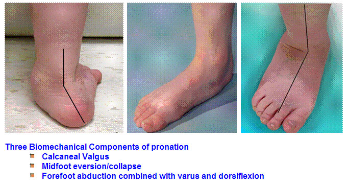 pronation1