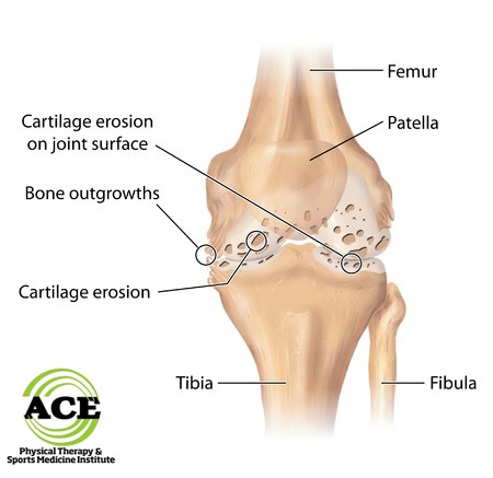 knee_diagram