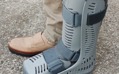 JONES FRACTURE AND PHYSICAL THERAPY